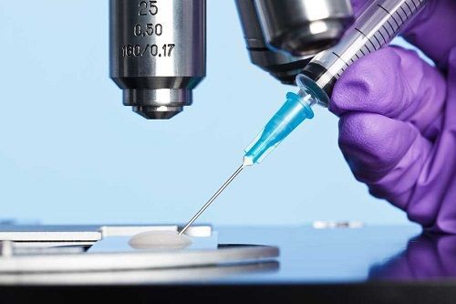 сдача анализов на азоспермию сдача анализов на азоспермию